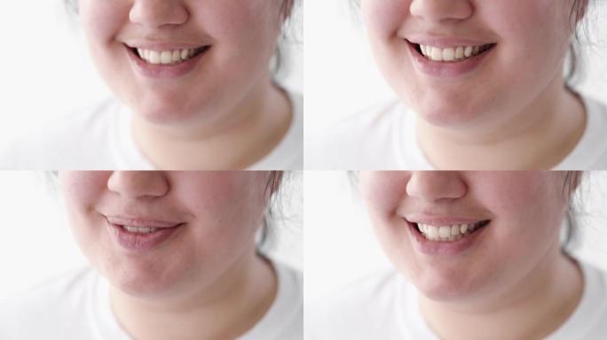 牙齿护理牙齿美白超重女人微笑