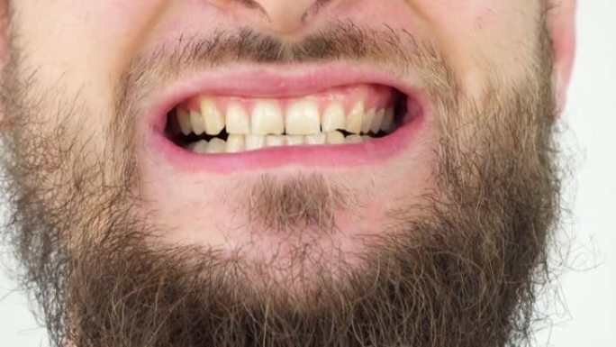留着胡须的高加索人特写镜头显示健康且黄色的牙齿。一个成年男人的微笑。脸部特写微笑的牙齿孤立的细节。