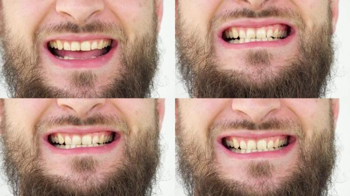 留着胡须的高加索人特写镜头显示健康且黄色的牙齿。一个成年男人的微笑。脸部特写微笑的牙齿孤立的细节。