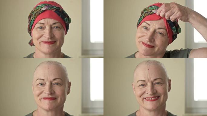 一位患有癌症的老年妇女的肖像。从光头上脱下围巾。化疗导致脱发。尽管痛苦，恐惧和绝望，女人还是微笑