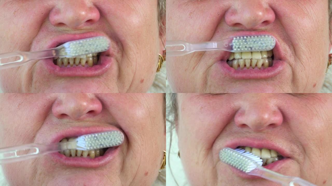 白人妇女微笑着刷牙。一张脸的特写。嘴唇和口腔卫生。照顾木屐和牙龈。牙医和检查。我们用牙刷正确地清洁它