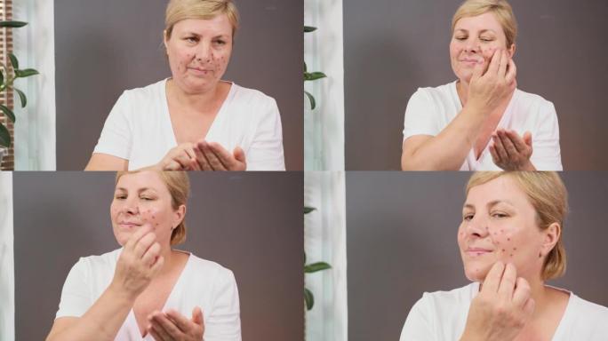 有痤疮问题的女人将乳霜挤入手掌，用手指取一点乳霜，并以圆周运动涂抹脸颊。