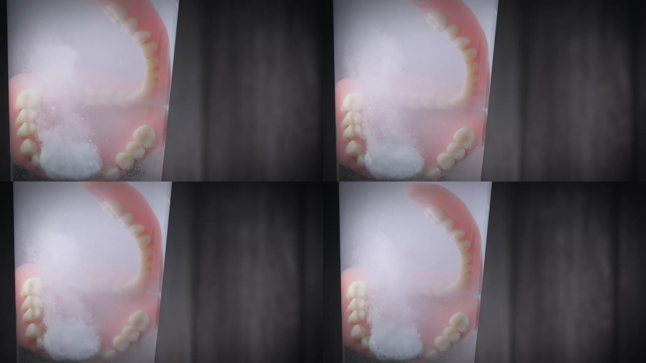 用溶解片剂清洁假体牙齿的特写镜头。