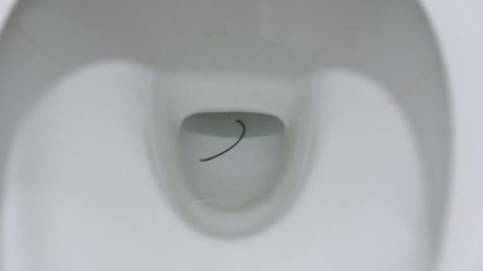厕所人体肠道蛔虫