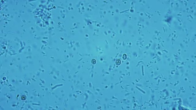显微镜下的人类牙菌斑。在框架中可以看到成千上万种不同的细菌。框内葡萄球菌、链球菌、念珠菌和酵母菌