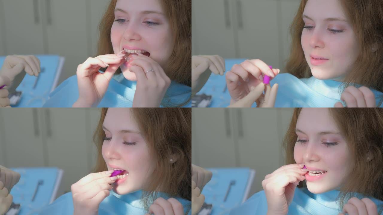 正畸医生在女孩的牙齿上安装硅胶透明牙套。