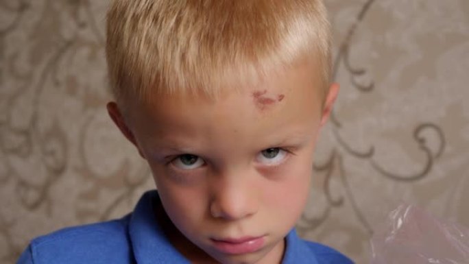 一个伤心的小男孩的肖像，额头上有擦伤和肿块。