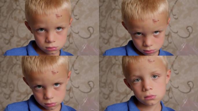 一个伤心的小男孩的肖像，额头上有擦伤和肿块。