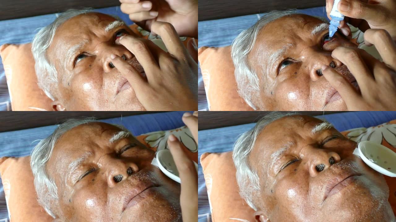 眼药水少滴患者高龄人眼角膜移植手术后