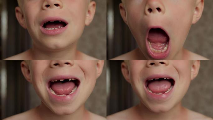 一个小男孩的特写镜头显示了他脱落的乳牙。