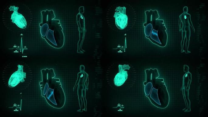 人心脏右心房和心室