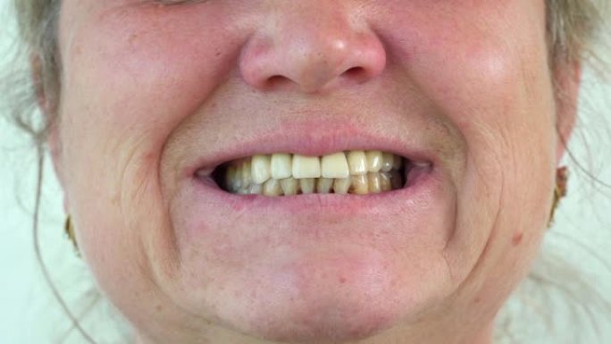 成年女人微笑着露出舌头，喉咙。快乐女人特写。张大嘴，舌头突出的肖像。向牙医展示健康的黄色牙齿。嘴唇薄