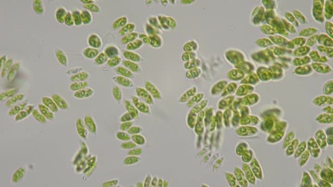 小群单细胞藻类在显微镜下漂浮在液体中。在生物实验室进行研究。1000倍放大。