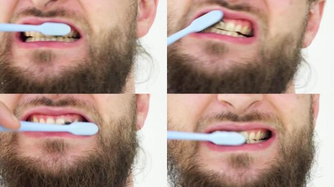 刷牙牙刷。口腔卫生。需要牙医帮助。烟嘴有黄色染色牙齿的高加索人。严重吸烟者生病了。吸烟者的弯曲牙齿覆