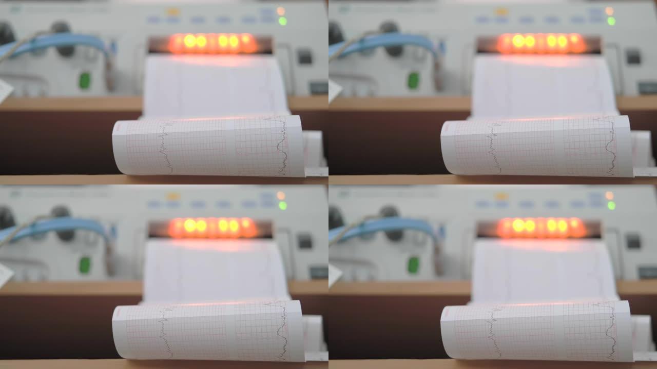CTG机器在交付时带有打印的心电图