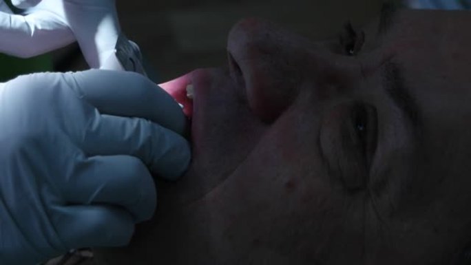 牙医在病人的嘴里放了一个印模托盘