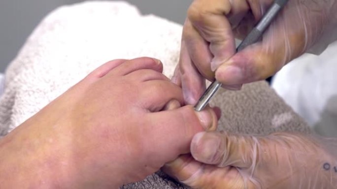 足疗师使用角质层推进器来防止指甲向内生长