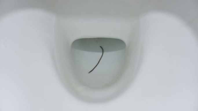 厕所人体肠道蛔虫