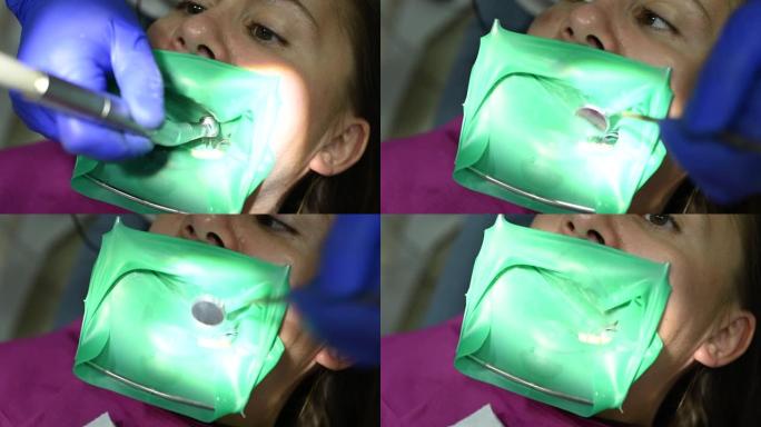 牙医治疗患者的牙齿，使用橡胶坝进行优质治疗。
