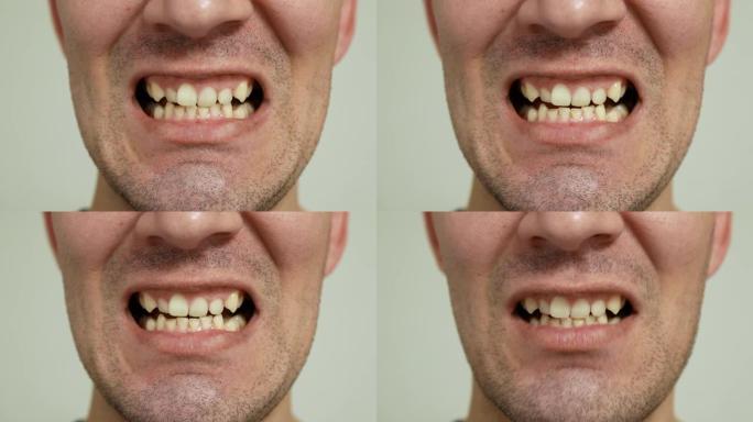 男人显示出黄色，弯曲和磨损的牙齿