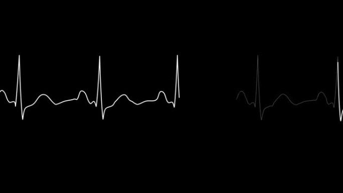 心电图循环。PNG Alpha。正常窦性心律。心率。心跳线模板。心电图监视器