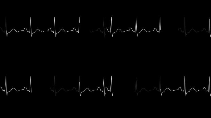 心电图循环。PNG Alpha。正常窦性心律。心率。心跳线模板。心电图监视器
