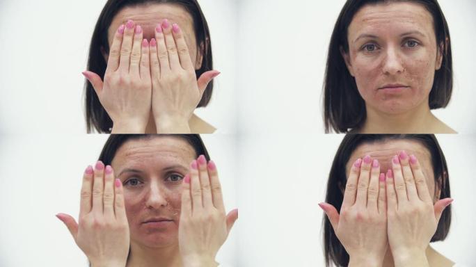 4k特写视频，女性有皮肤问题，隐藏她的脸。