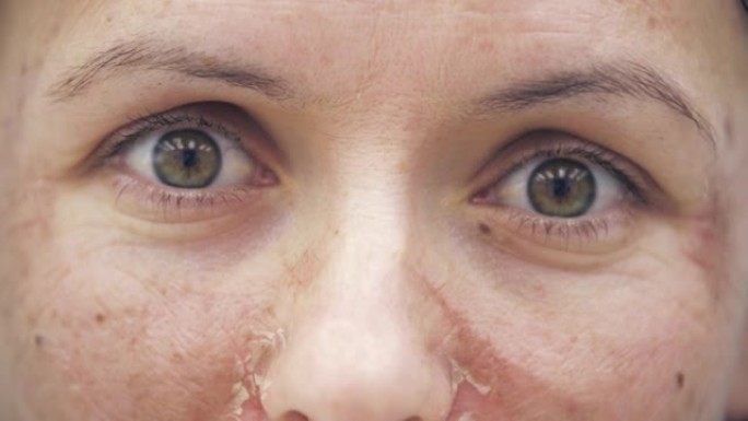皮肤干燥的女性面部的4k慢动作视频。