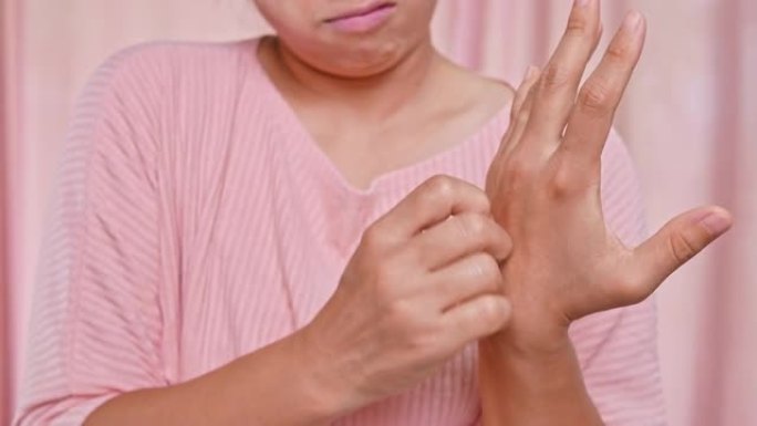 恼怒的中年妇女从发痒的干燥皮肤，湿疹，皮炎，过敏，牛皮癣的手抓痒。保健和皮肤病概念。