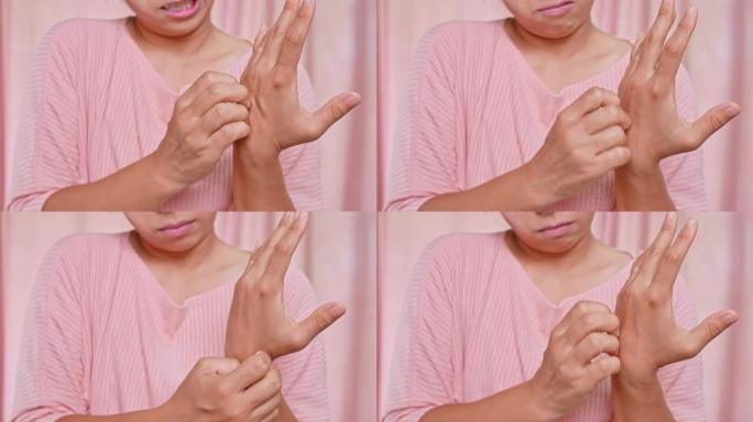 恼怒的中年妇女从发痒的干燥皮肤，湿疹，皮炎，过敏，牛皮癣的手抓痒。保健和皮肤病概念。