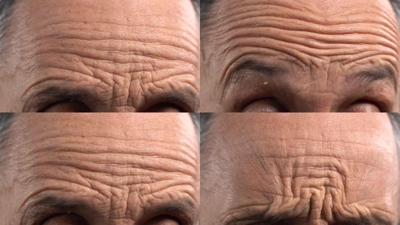 皱巴巴的男性前额特写。成熟男人的前额和皱纹。