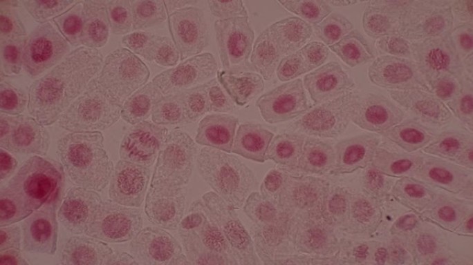 显微镜下洋葱根尖和有丝分裂细胞。