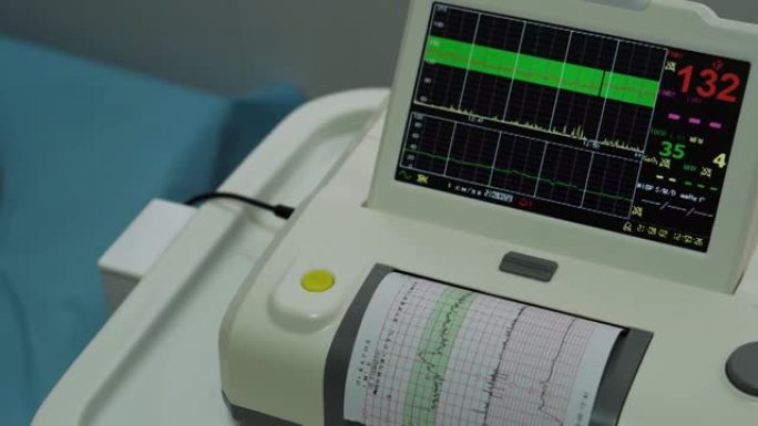 电子心脏照相机监测胎儿子宫的心脏收缩。打印心电图报告怀孕期间产房心电图。医疗诊断设备