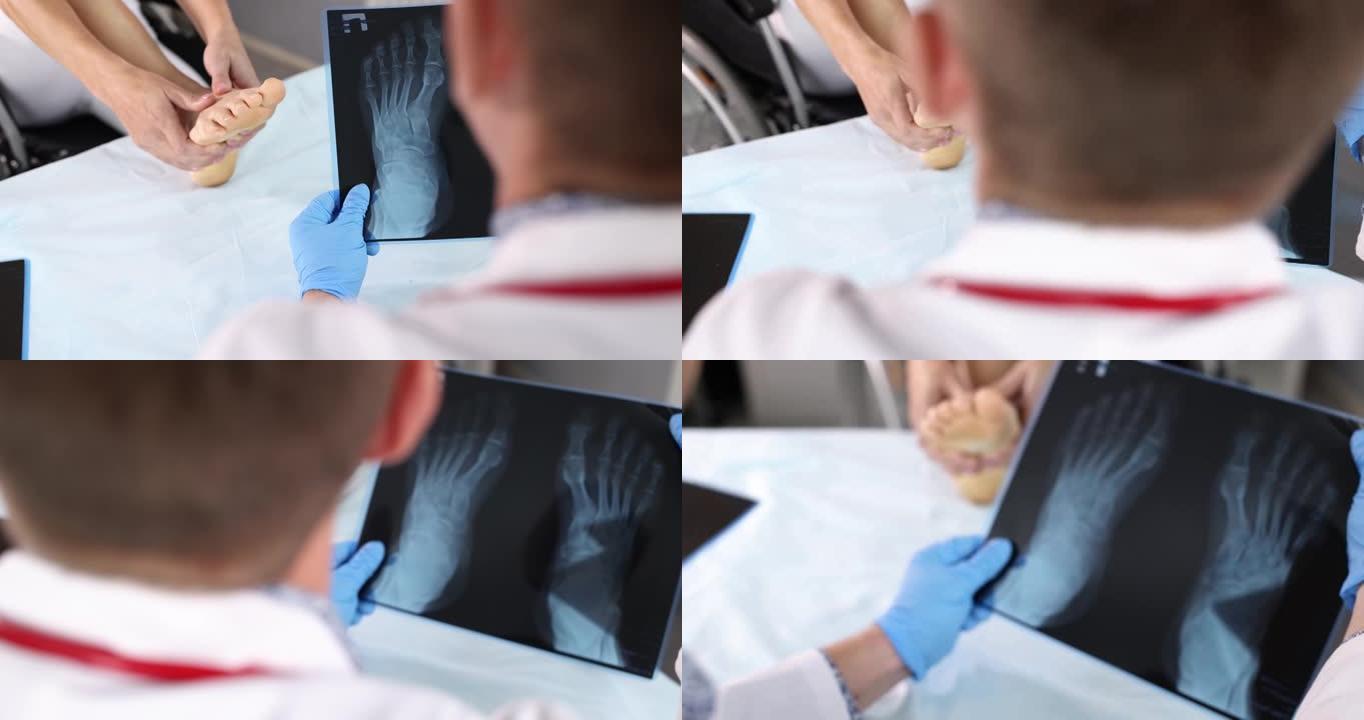 外科医生检查疼痛综合征患者的脚x射线4k电影