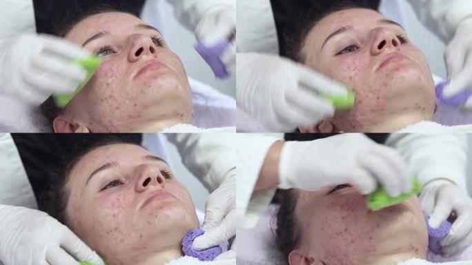年轻女子在面部护理中使用特殊凝胶在美容水疗中心进行痤疮问题皮肤疗法