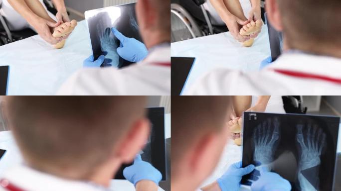 医生检查脚痛患者的x射线4k电影