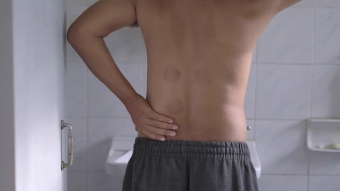 男子在中医诊所接受真空拔罐治疗后背部疼痛慢动作4K