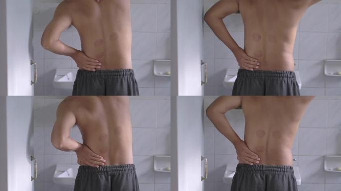 男子在中医诊所接受真空拔罐治疗后背部疼痛慢动作4K