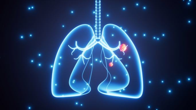 人类肺部肿瘤增长动画
