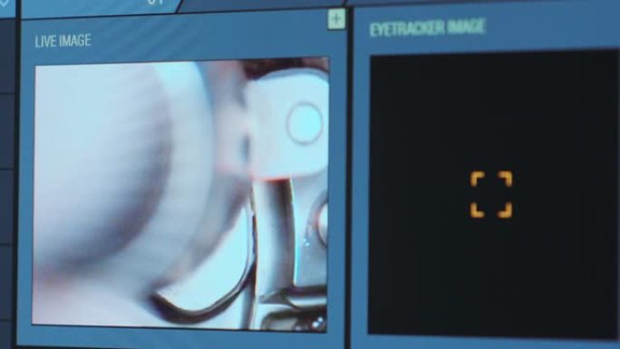 眼科手术。在手术室医疗监护仪的屏幕上查看。Lasik