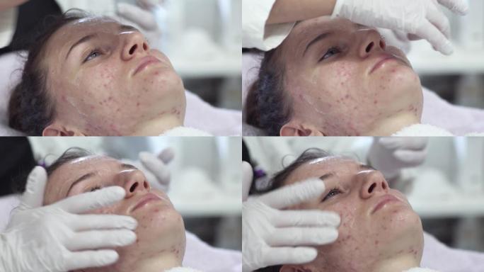 皮肤科医生或化妆品沙龙对年轻女性有问题的皮肤进行痤疮治疗