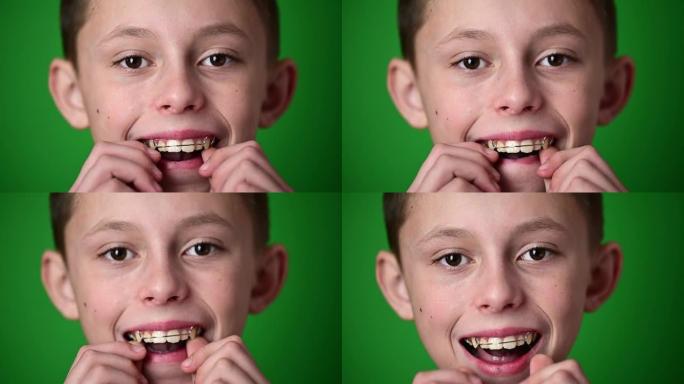 孩子放在牙板上，以对齐弯曲的牙齿，绿色背景上的孩子肖像。