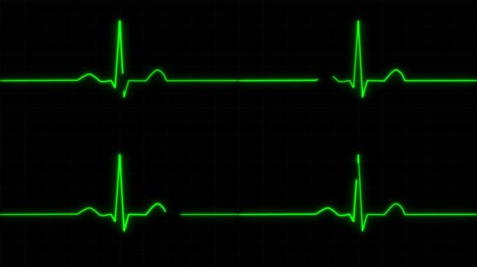 概念2-E1逼真心脏脉搏监视器动画