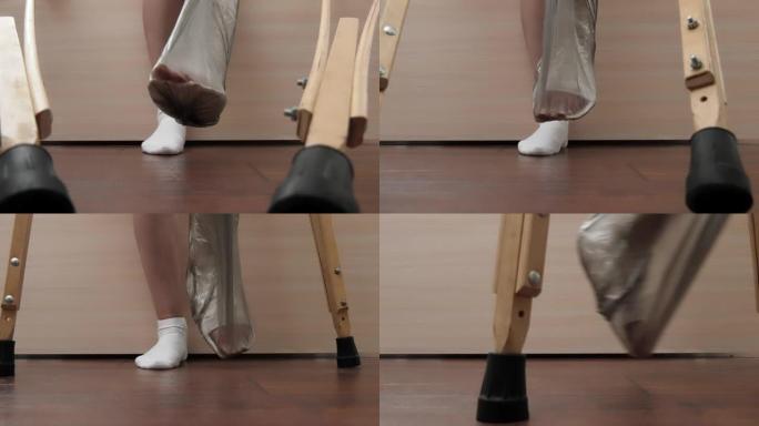 一个腿部骨折的女人拄着拐杖站起来，在房间里走来走去。防潮石膏。保护石膏绷带不受潮。