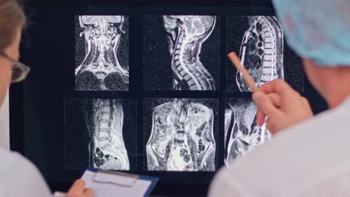 两名医生正在计算机屏幕上检查患者脊柱的x射线。