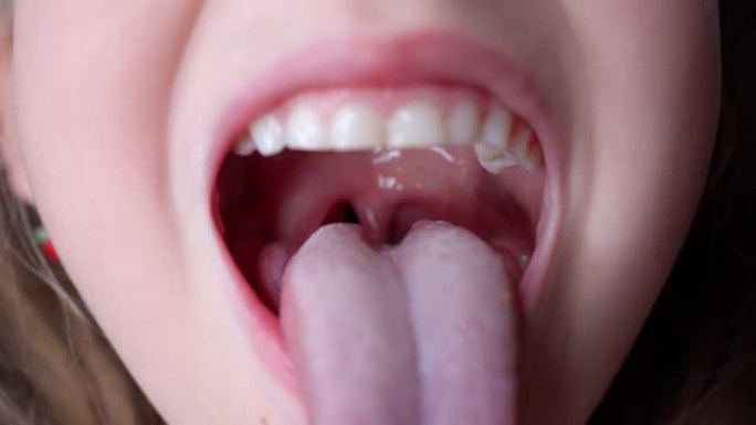 女孩张开嘴，拔出长舌头。孩子露出牙齿柔软