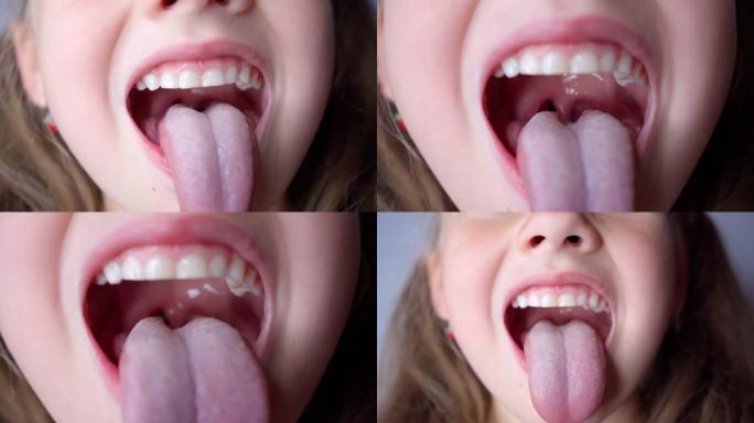 女孩张开嘴，拔出长舌头。孩子露出牙齿柔软