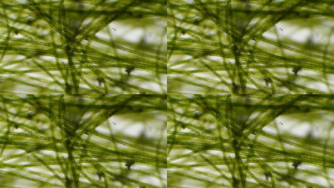 显微镜下的叶绿体。细胞分裂。细胞结构。细胞分裂。叶片表面在显微镜下显示植物细胞。病毒感染。显微镜下的