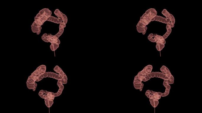 CT结肠造影三维渲染筛查大肠癌。检查结肠癌筛查。