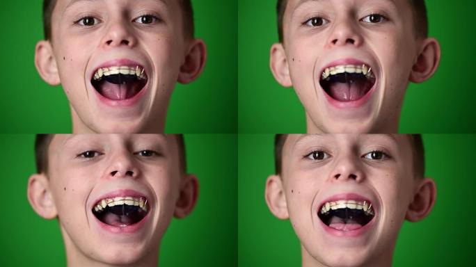 牙板用于在口腔中对齐牙齿，孩子戴着牙板用于矫正和对齐牙齿。